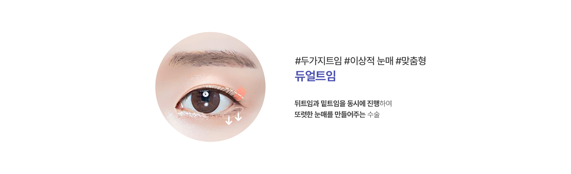 앞트임