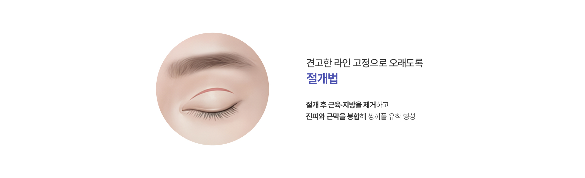 절개법