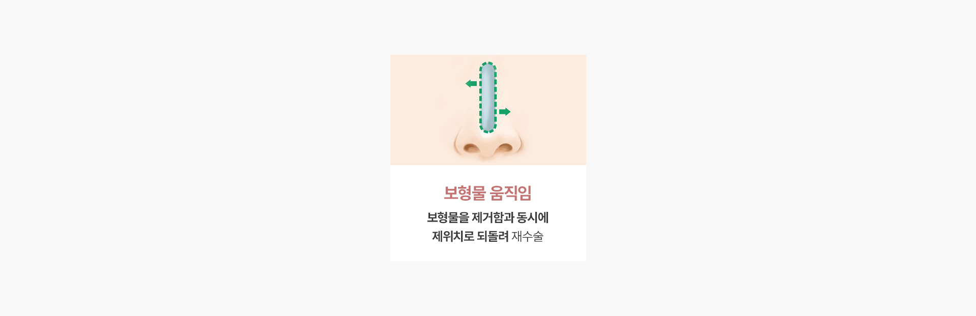보형물 움직임