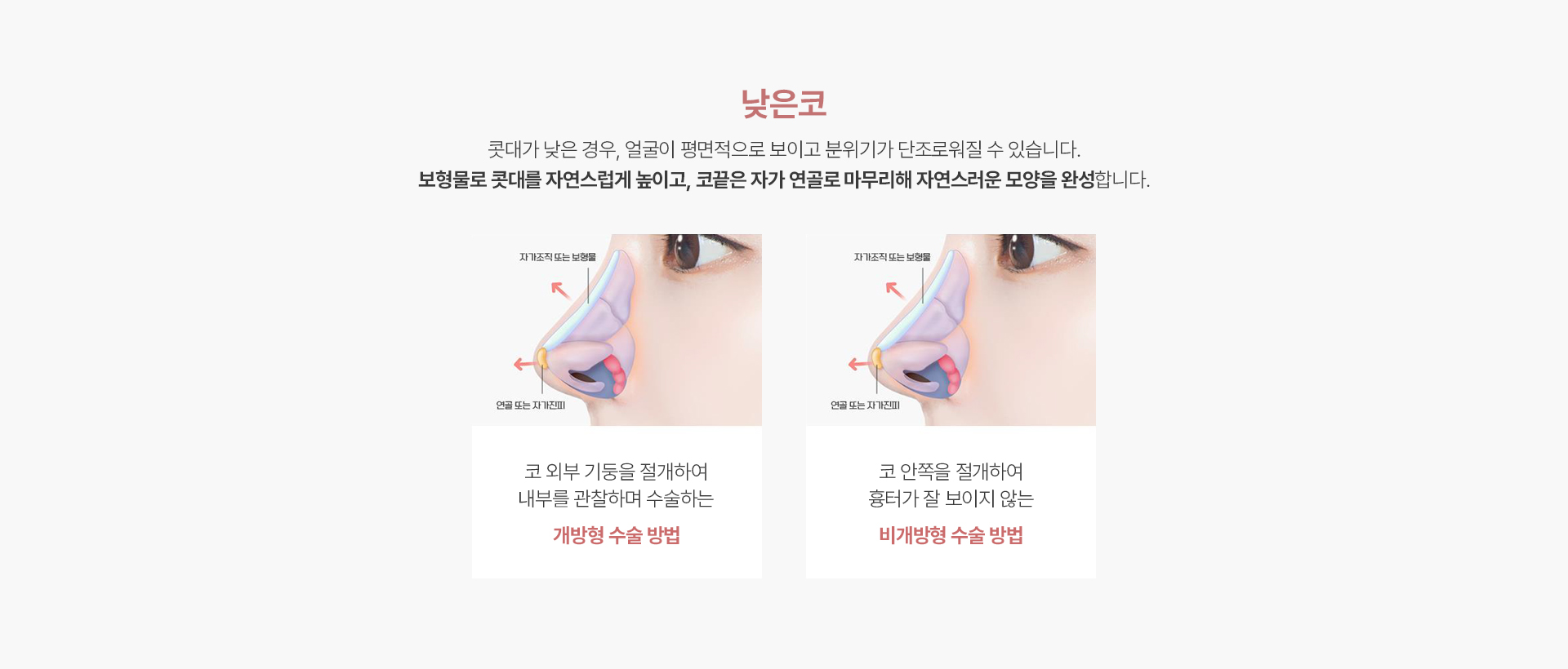 낮은코