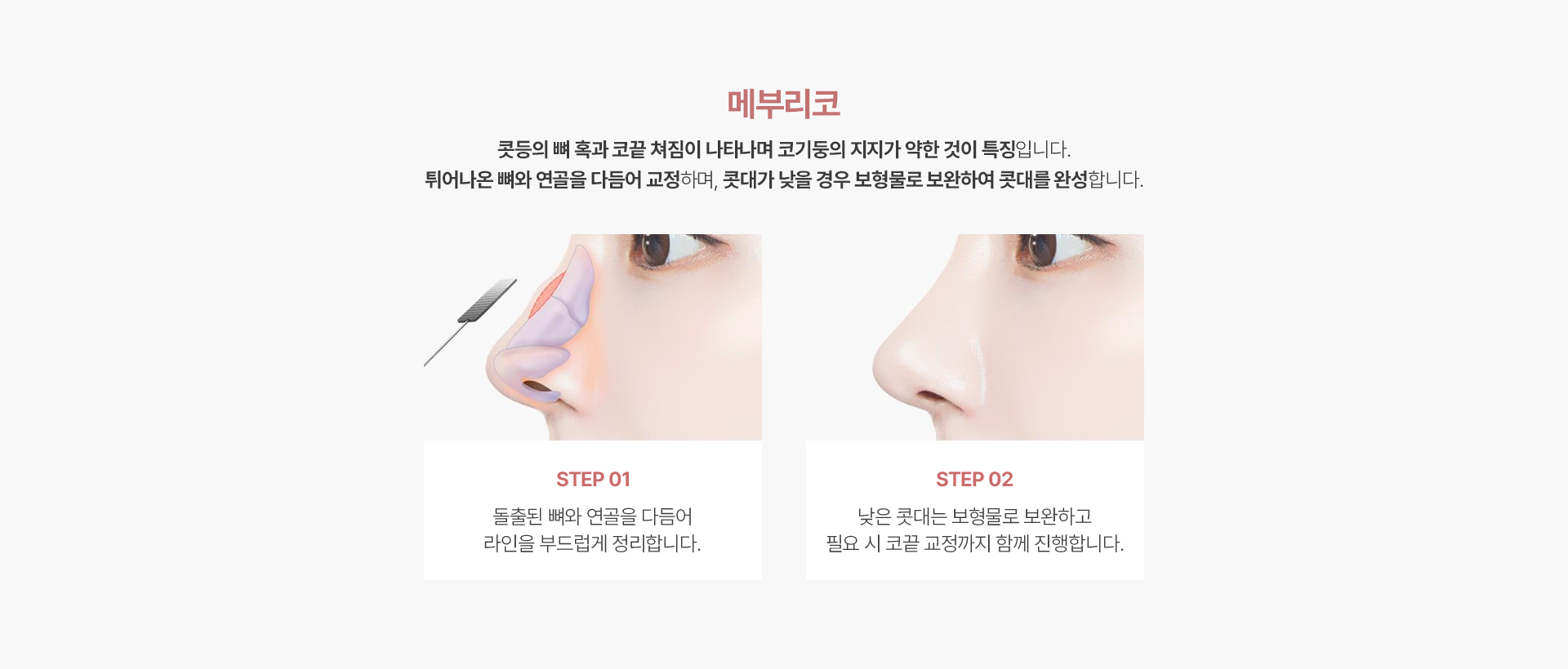 매부리코