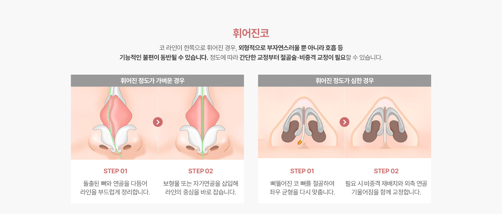 휘어진코