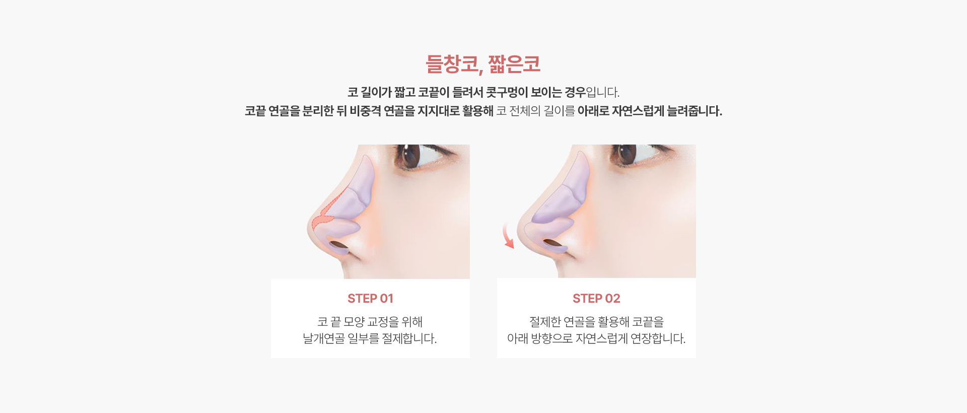 들창코,짧은코