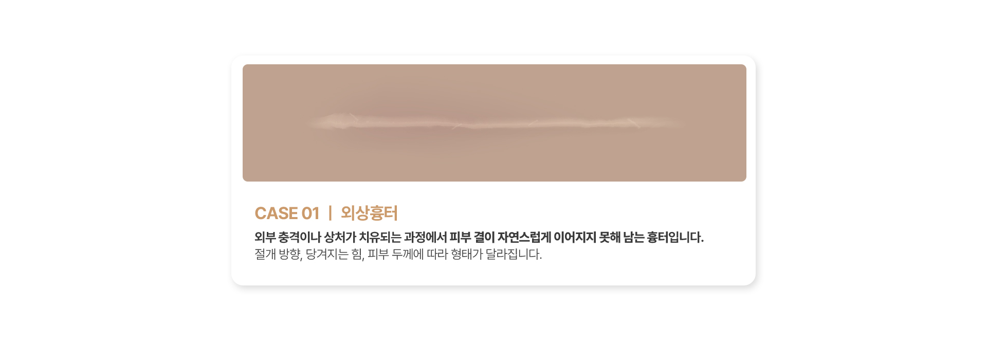 외상 흉터
