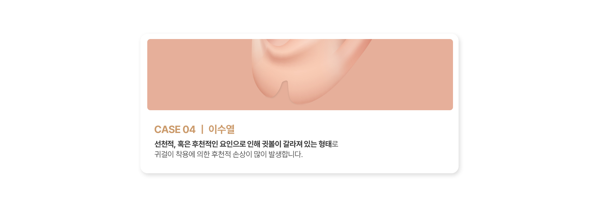 이수열