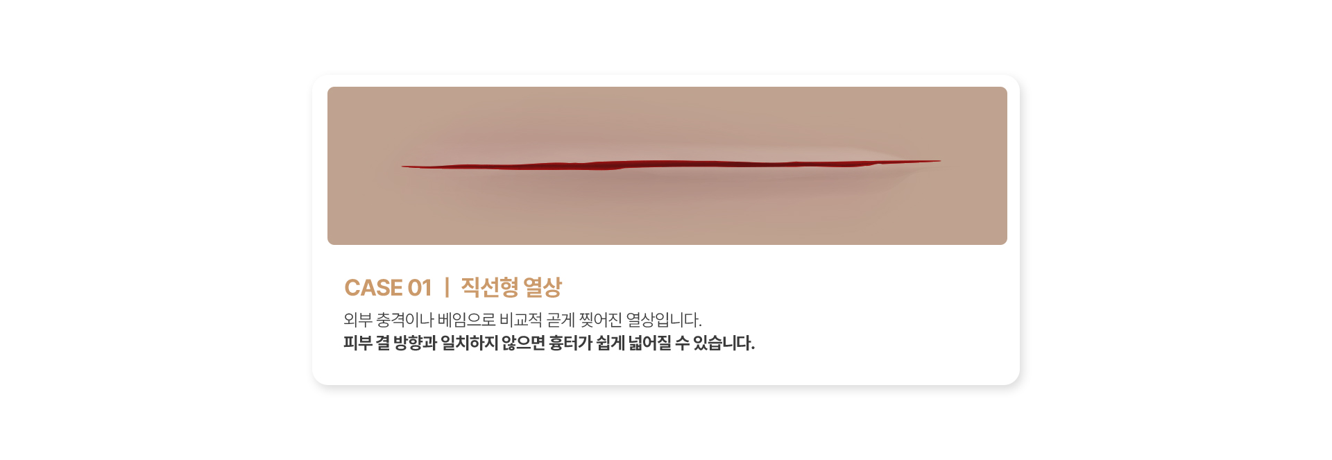 직선형 열상