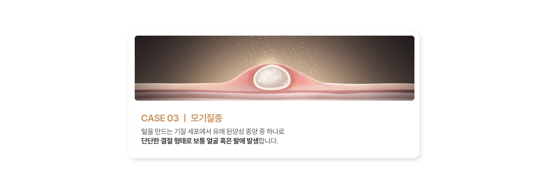 모기질종